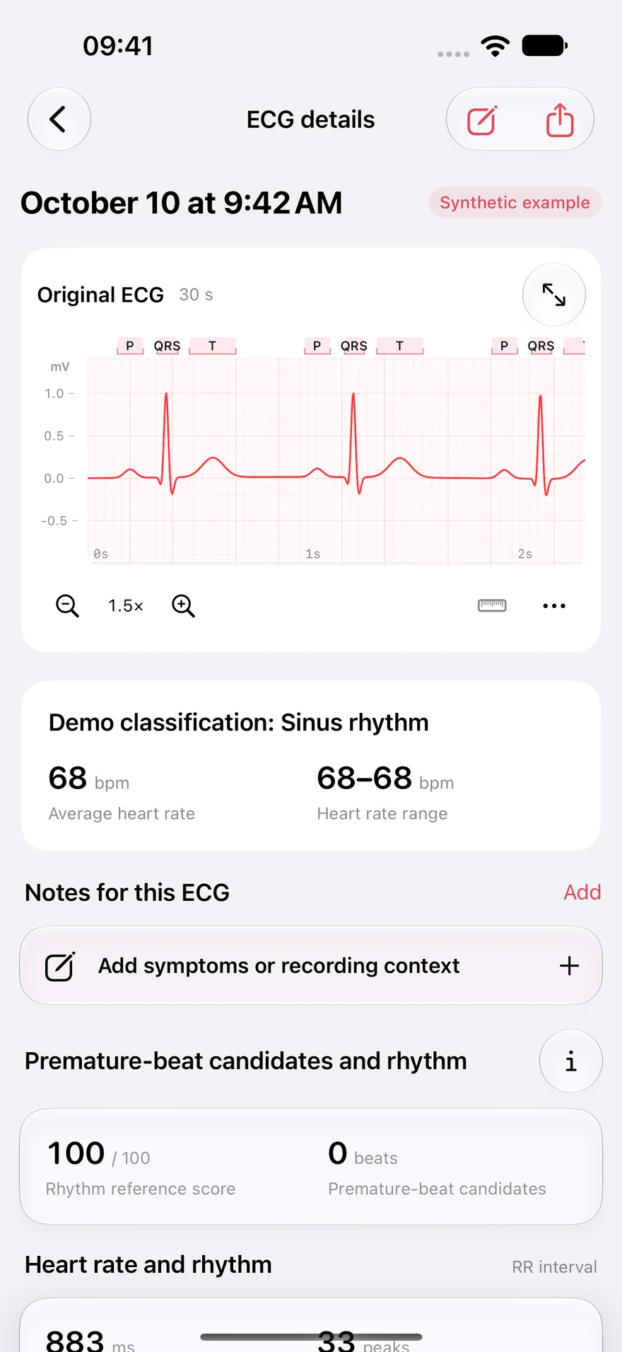 HeartPro showing a synthetic ECG waveform with zoom and measurement controls