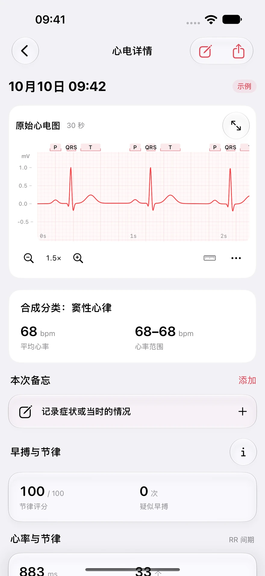 HeartPro 的合成心电波形及缩放、手动测量控件